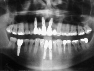 rx-odontologia